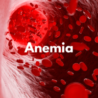 Anemia